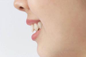 「ぷるきら」で潤いを手に入れる！自然派リップクリームの魅力と選び方ガイド